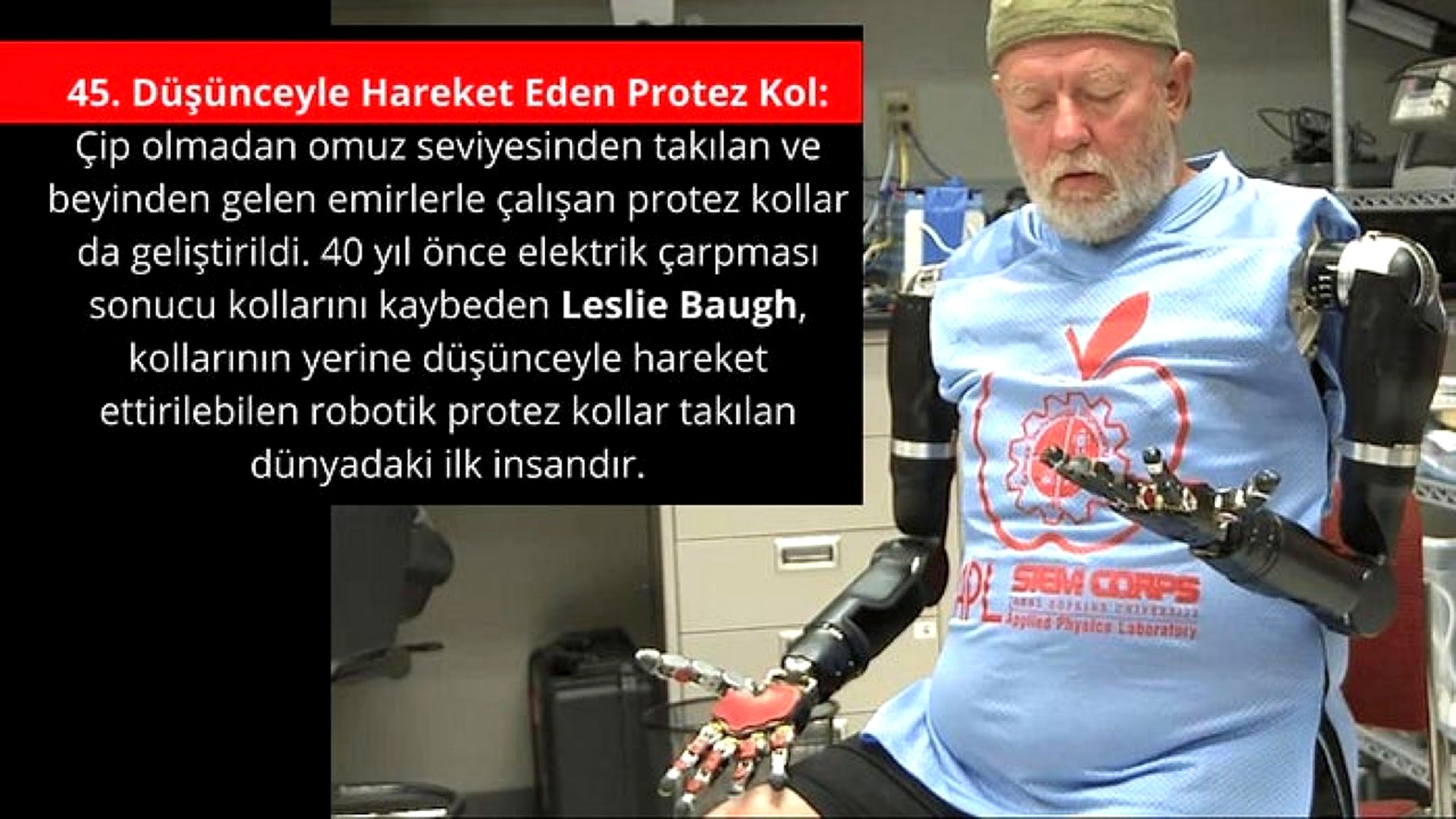 Düşünceyle protez kol