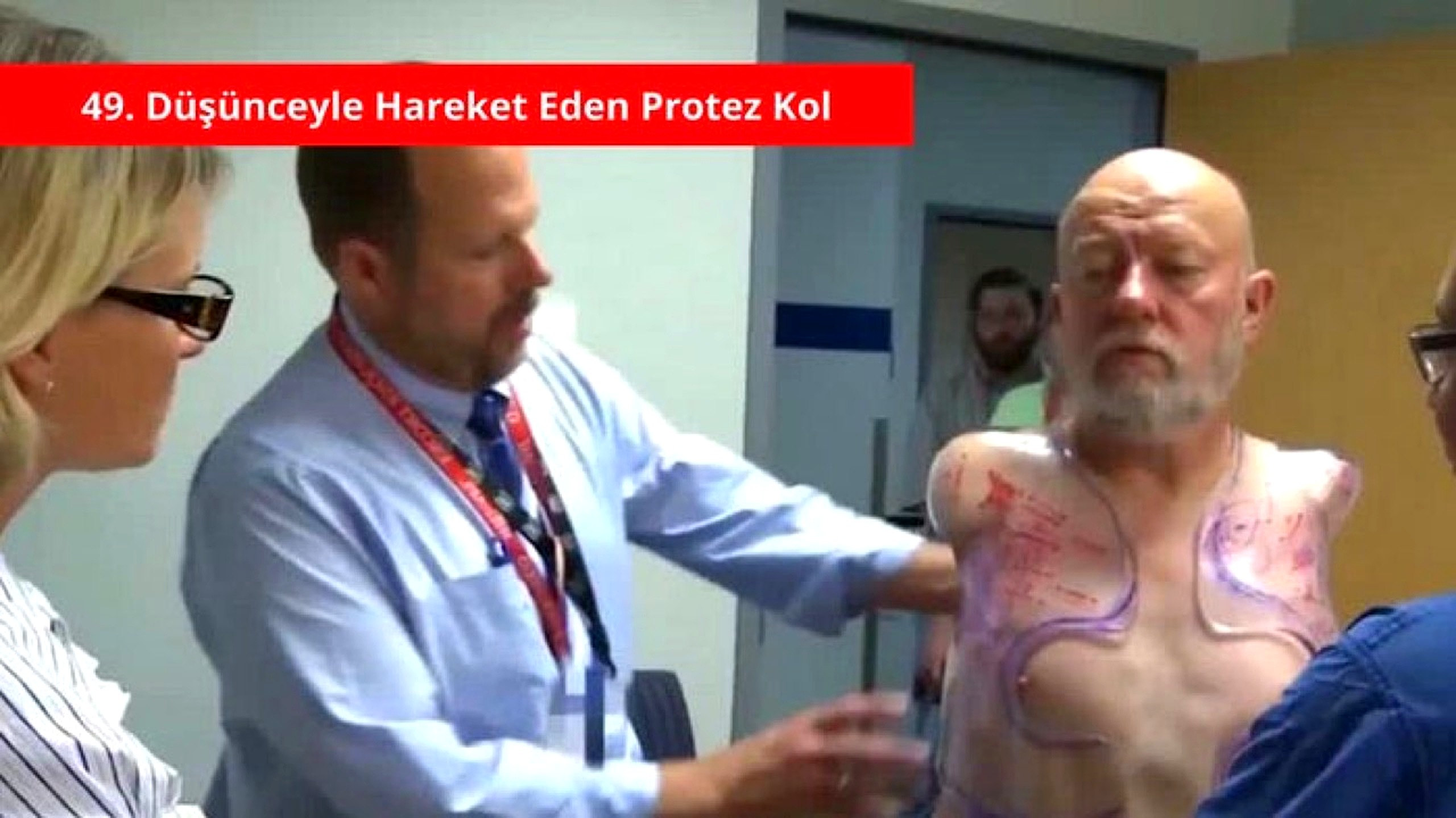 Düşünceyle protez kol detay